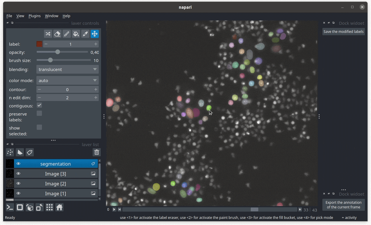 roi_annotation